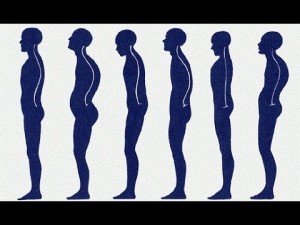 Exercises to improve posture